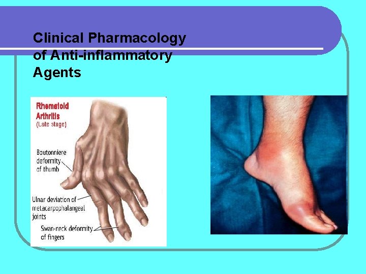Clinical Pharmacology of Anti-inflammatory Agents 