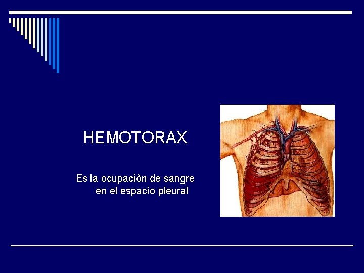 HEMOTORAX Es la ocupaciòn de sangre en el espacio pleural 