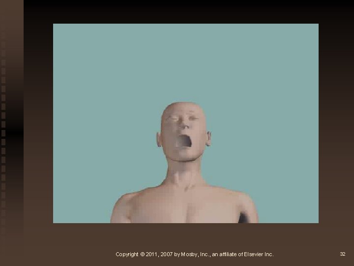 Copyright © 2011, 2007 by Mosby, Inc. , an affiliate of Elsevier Inc. 32