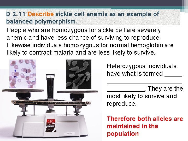 D 2. 11 Describe sickle cell anemia as an example of balanced polymorphism. People