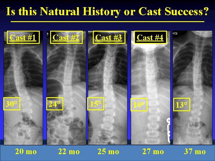 Is this Natural History or Cast Success? Cast #1 30° 20 mo Cast #2