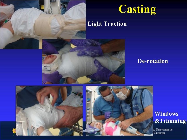 Casting Light Traction De-rotation Windows &Trimming 