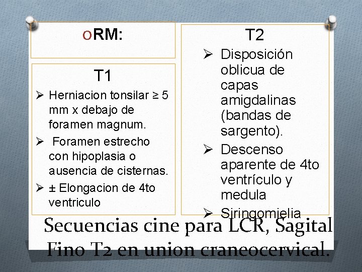 O RM: T 1 Ø Herniacion tonsilar ≥ 5 mm x debajo de foramen