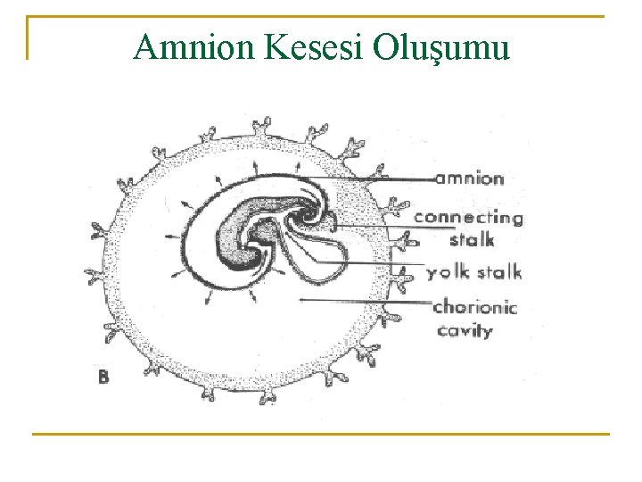 Amnion Kesesi Oluşumu 