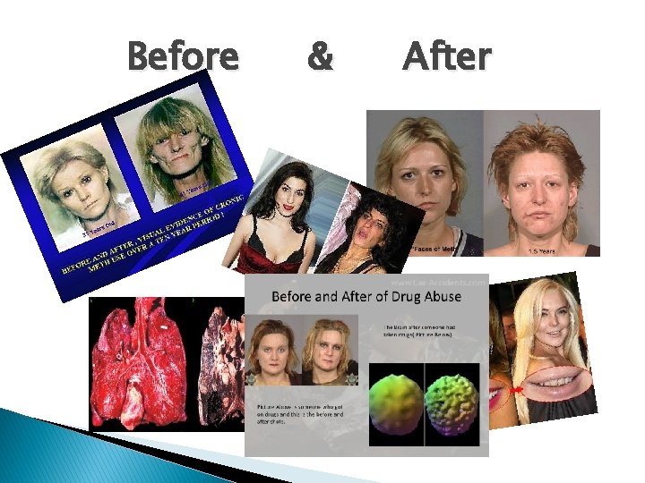 Before & After Before & After