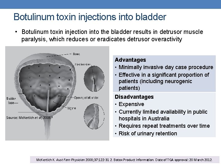 Botulinum toxin injections into bladder • Botulinum toxin injection into the bladder results in