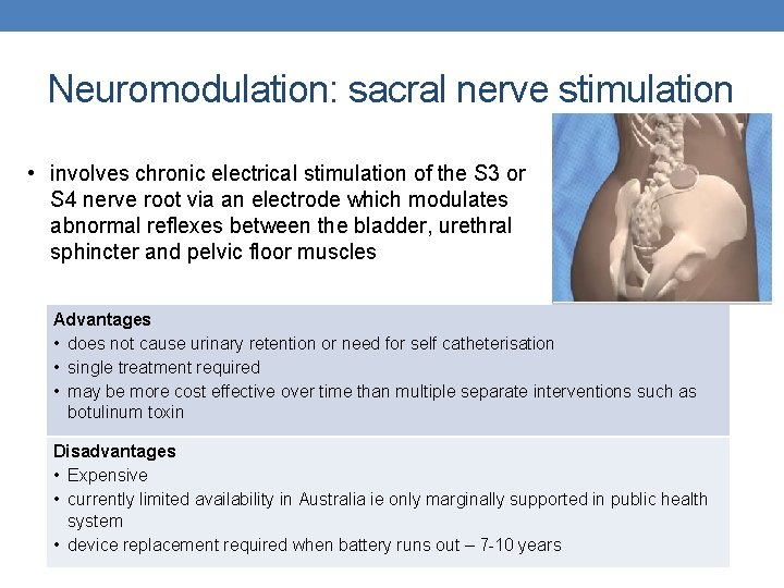 Neuromodulation: sacral nerve stimulation • involves chronic electrical stimulation of the S 3 or