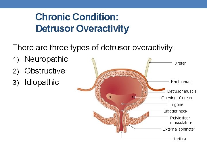 Chronic Condition: Detrusor Overactivity There are three types of detrusor overactivity: 1) Neuropathic Ureter