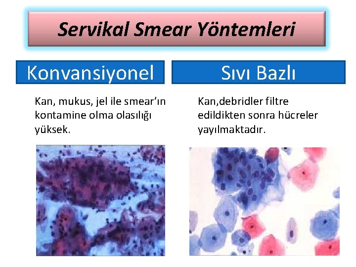 Servikal Smear Yöntemleri Konvansiyonel Kan, mukus, jel ile smear’ın kontamine olma olasılığı yüksek. Sıvı