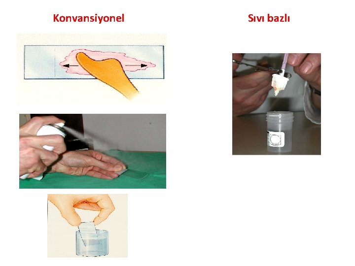 Konvansiyonel Sıvı bazlı 