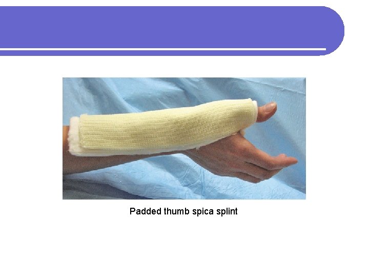 Padded thumb spica splint 