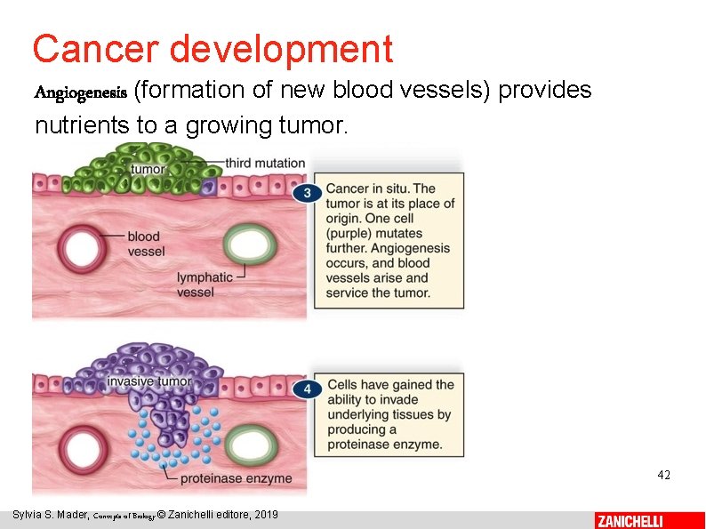 Cancer development Angiogenesis (formation of new blood vessels) provides nutrients to a growing tumor.