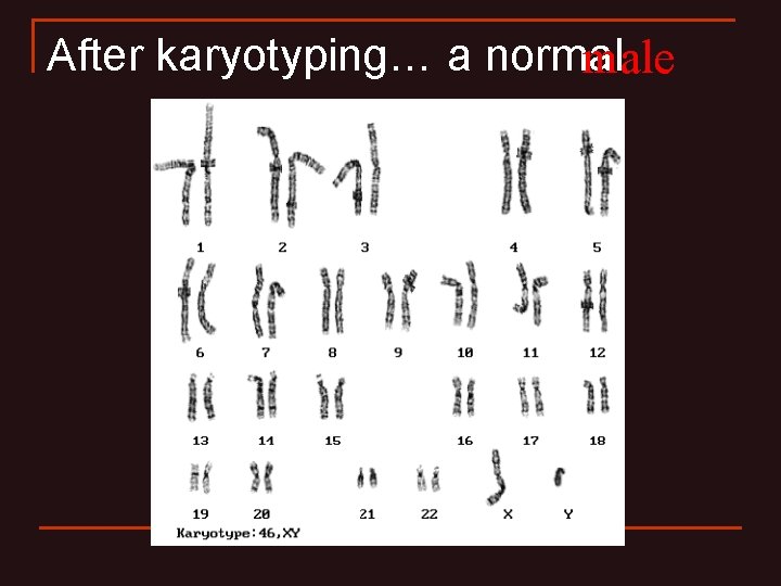 After karyotyping… a normal male After karyotyping… a normal male