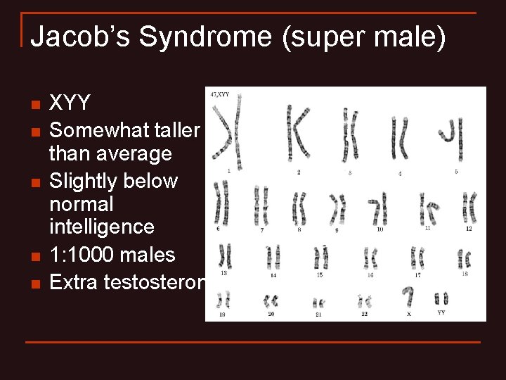 Jacob’s Syndrome (super male) n n n XYY Somewhat taller than average Slightly below Jacob’s Syndrome (super male) n n n XYY Somewhat taller than average Slightly below
