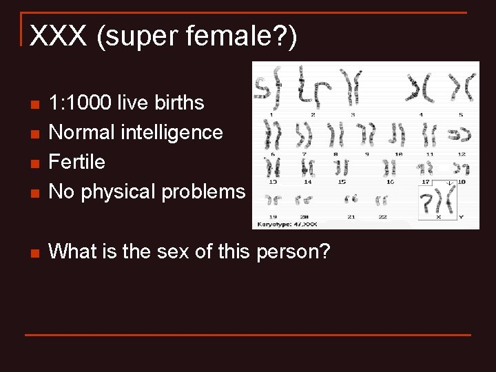 XXX (super female? ) n 1: 1000 live births Normal intelligence Fertile No physical XXX (super female? ) n 1: 1000 live births Normal intelligence Fertile No physical