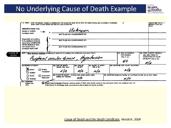 No Underlying Cause of Death Example Cause of Death and the Death Certificate, Hanzlick,