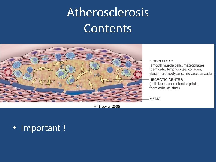 Atherosclerosis Contents • Important ! 