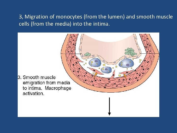 3, Migration of monocytes (from the lumen) and smooth muscle cells (from the media)