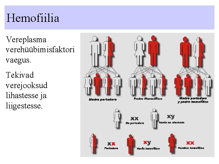 Hemofiilia Vereplasma verehüübimisfaktori vaegus. Tekivad verejooksud lihastesse ja liigestesse. Hemofiilia Vereplasma verehüübimisfaktori vaegus. Tekivad verejooksud lihastesse ja liigestesse.