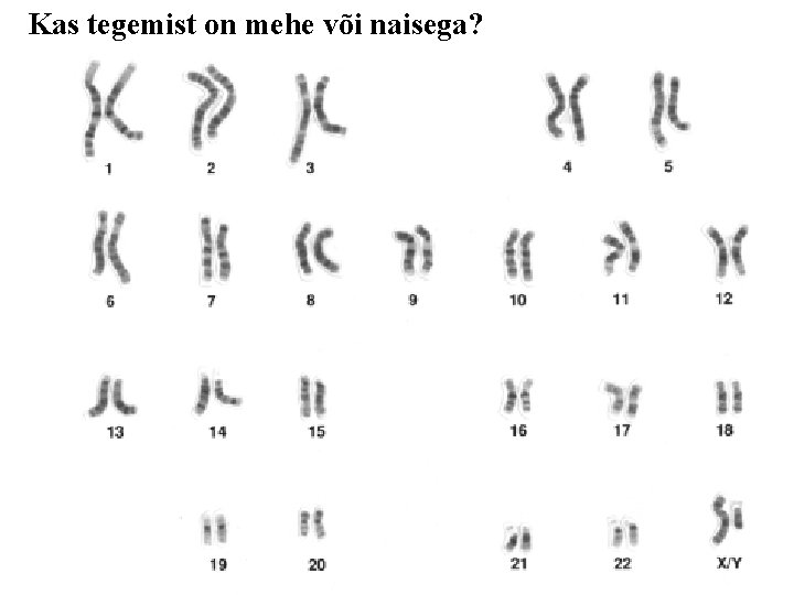 Kas tegemist on mehe või naisega? Kas tegemist on mehe või naisega?