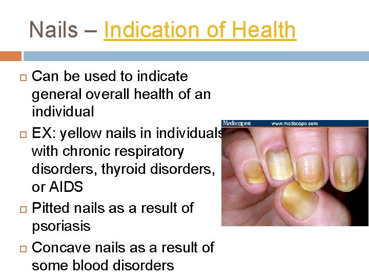 Nails – Indication of Health Can be used to indicate general overall health of