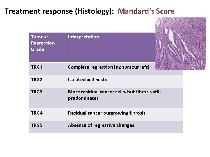 Treatment response (Histology): Mandard’s Score Tumour Regression Grade Interpretation TRG I Complete regression (no