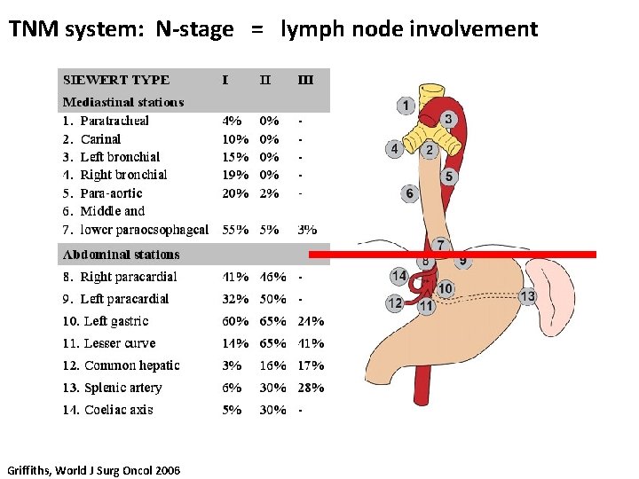 TNM system: N-stage = lymph node involvement Griffiths, World J Surg Oncol 2006 