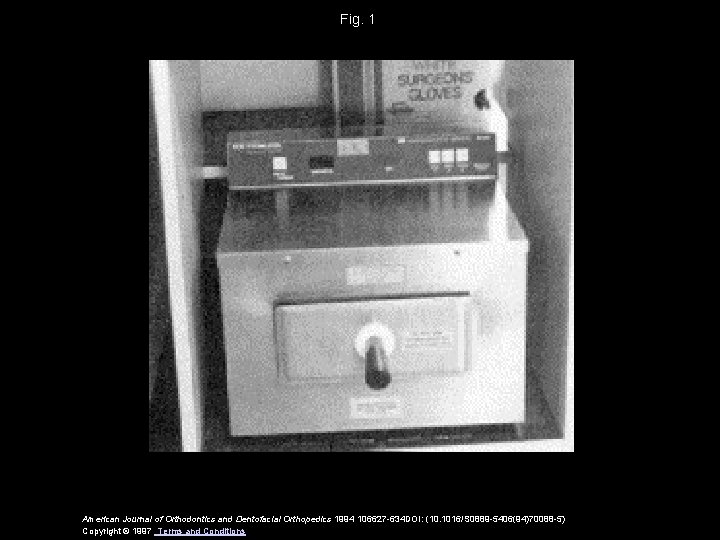 Fig. 1 American Journal of Orthodontics and Dentofacial Orthopedics 1994 106627 -634 DOI: (10. Fig. 1 American Journal of Orthodontics and Dentofacial Orthopedics 1994 106627 -634 DOI: (10.