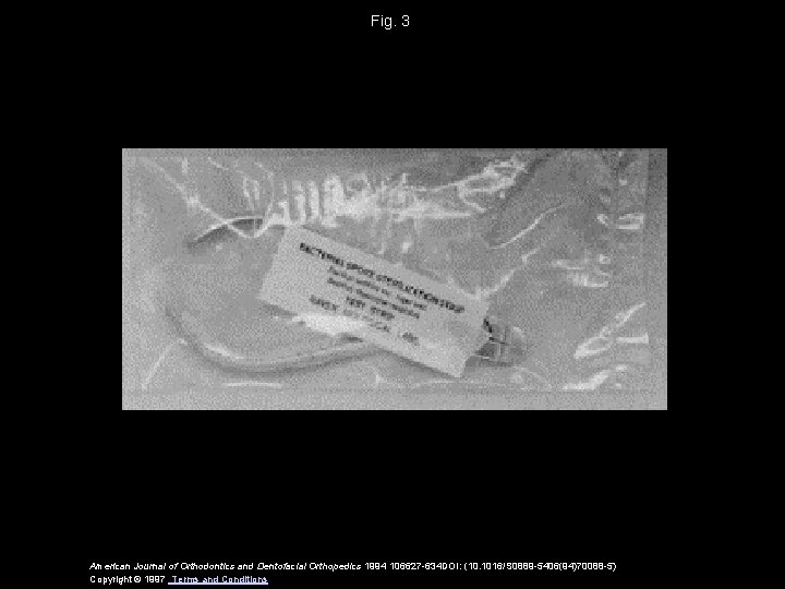 Fig. 3 American Journal of Orthodontics and Dentofacial Orthopedics 1994 106627 -634 DOI: (10. Fig. 3 American Journal of Orthodontics and Dentofacial Orthopedics 1994 106627 -634 DOI: (10.