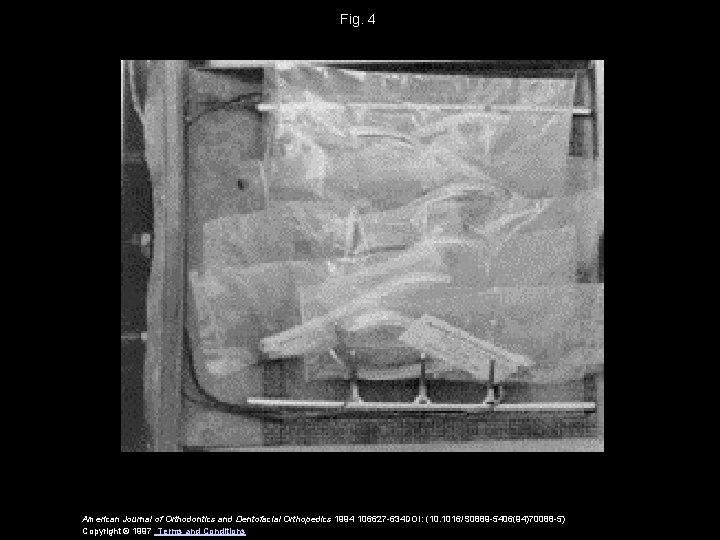 Fig. 4 American Journal of Orthodontics and Dentofacial Orthopedics 1994 106627 -634 DOI: (10. Fig. 4 American Journal of Orthodontics and Dentofacial Orthopedics 1994 106627 -634 DOI: (10.