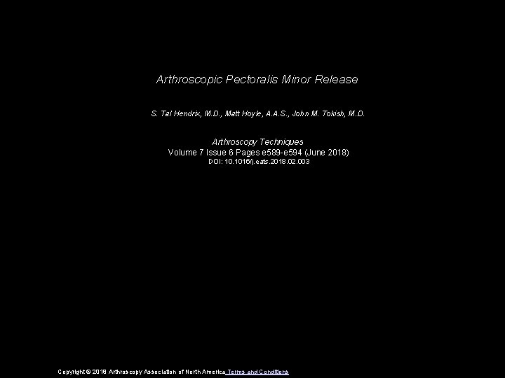 Arthroscopic Pectoralis Minor Release S. Tal Hendrix, M. D. , Matt Hoyle, A. A.
