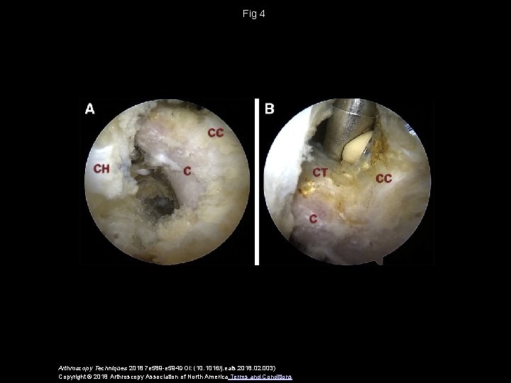 Fig 4 Arthroscopy Techniques 2018 7 e 589 -e 594 DOI: (10. 1016/j. eats.