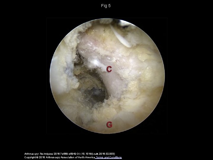 Fig 5 Arthroscopy Techniques 2018 7 e 589 -e 594 DOI: (10. 1016/j. eats.