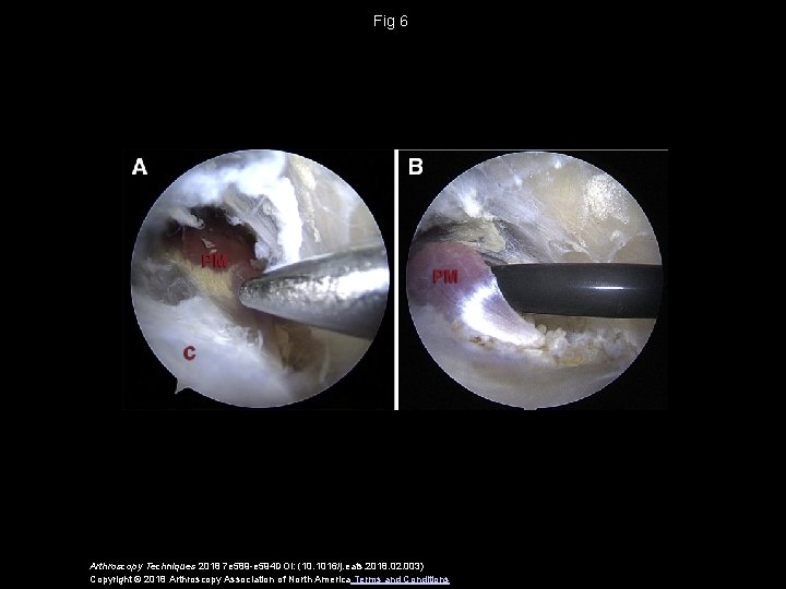 Fig 6 Arthroscopy Techniques 2018 7 e 589 -e 594 DOI: (10. 1016/j. eats.