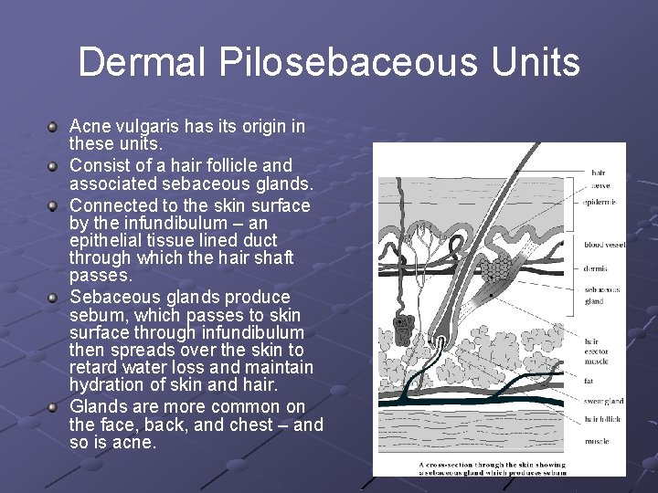 Dermal Pilosebaceous Units Acne vulgaris has its origin in these units. Consist of a