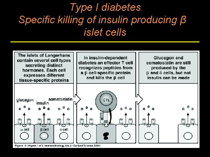 Type I diabetes Specific killing of insulin producing β islet cells 