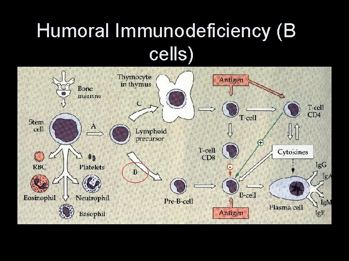 Humoral Immunodeficiency (B cells) 