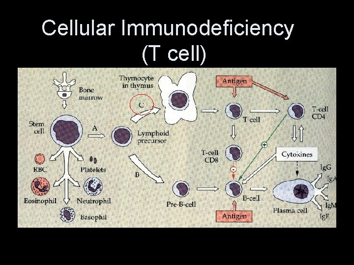 Cellular Immunodeficiency (T cell) 