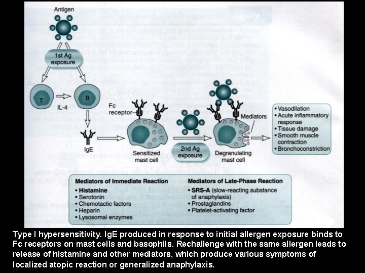 Type I hypersensitivity. Ig. E produced in response to initial allergen exposure binds to
