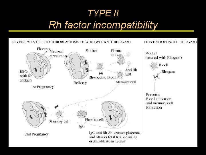 TYPE II Rh factor incompatibility 