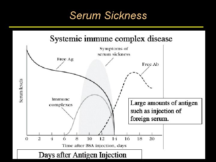 Serum Sickness 