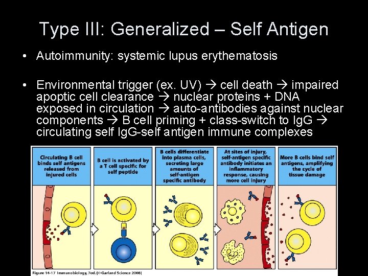 Type III: Generalized – Self Antigen • Autoimmunity: systemic lupus erythematosis • Environmental trigger