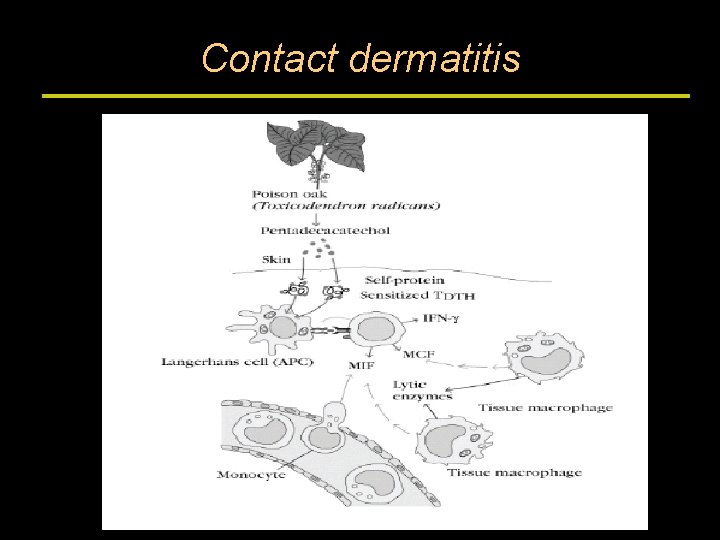 Contact dermatitis 