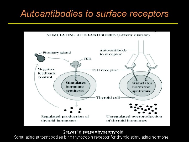 Autoantibodies to surface receptors Graves' disease =hyperthyroid Stimulating autoantibodies bind thyrotropin receptor for thyroid