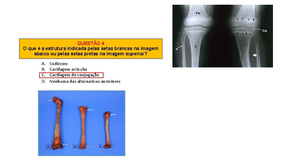 QUESTÃO 4 O que é a estrutura indicada pelas setas brancas na imagem abaixo
