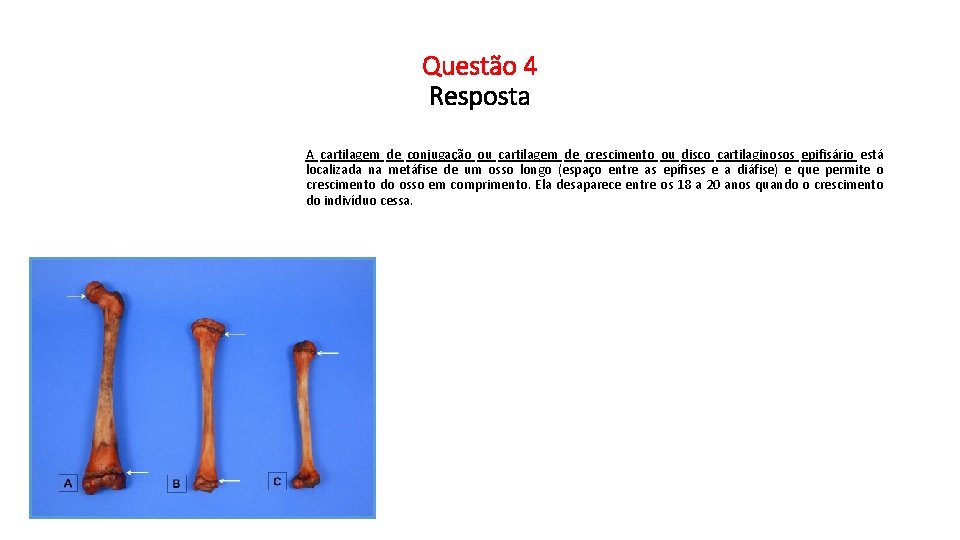 Questão 4 Resposta A cartilagem de conjugação ou cartilagem de crescimento ou disco cartilaginosos