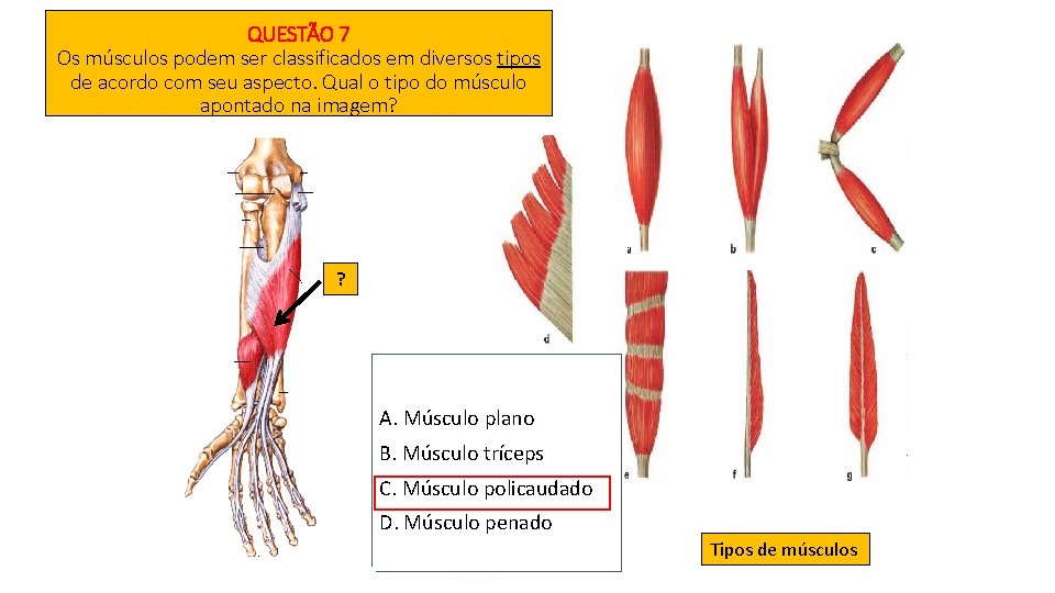 QUESTÃO 7 Os músculos podem ser classificados em diversos tipos de acordo com seu