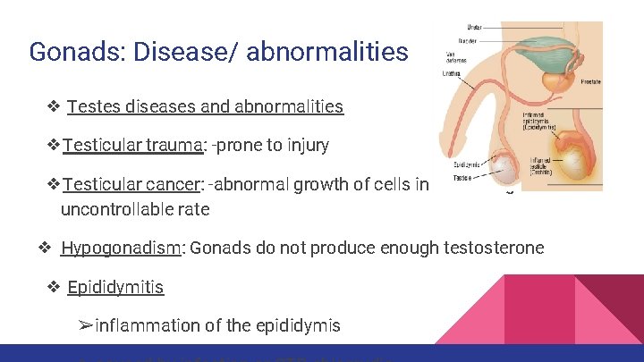 Gonads: Disease/ abnormalities ❖ Testes diseases and abnormalities ❖Testicular trauma: -prone to injury ❖Testicular