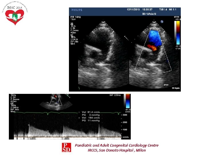 Paediatric and Adult Congenital Cardiology Centre IRCCS, San Donato Hospital , Milan Paediatric and Adult Congenital Cardiology Centre IRCCS, San Donato Hospital , Milan