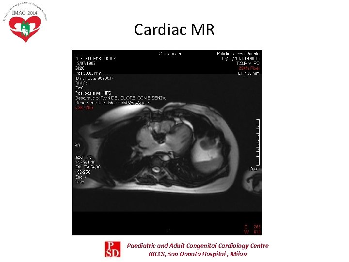 Cardiac MR Paediatric and Adult Congenital Cardiology Centre IRCCS, San Donato Hospital , Milan Cardiac MR Paediatric and Adult Congenital Cardiology Centre IRCCS, San Donato Hospital , Milan